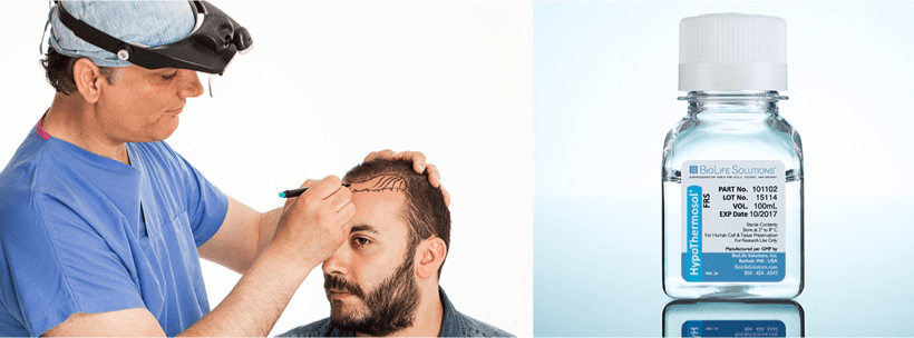ht-hair-tablet