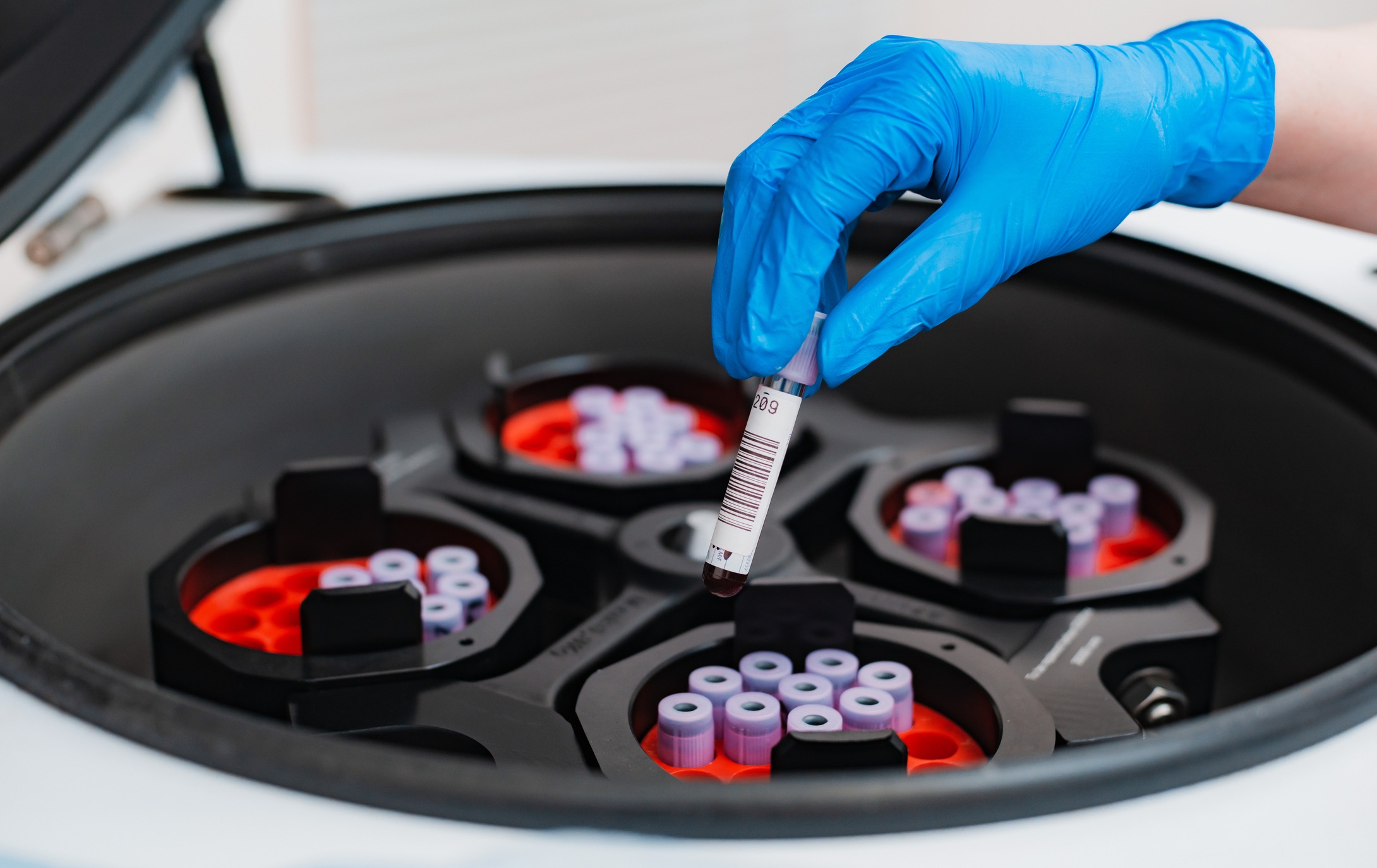 Blue-gloved hand placing a labeled blood sample tube into a laboratory centrifuge loaded with multiple test tubes.